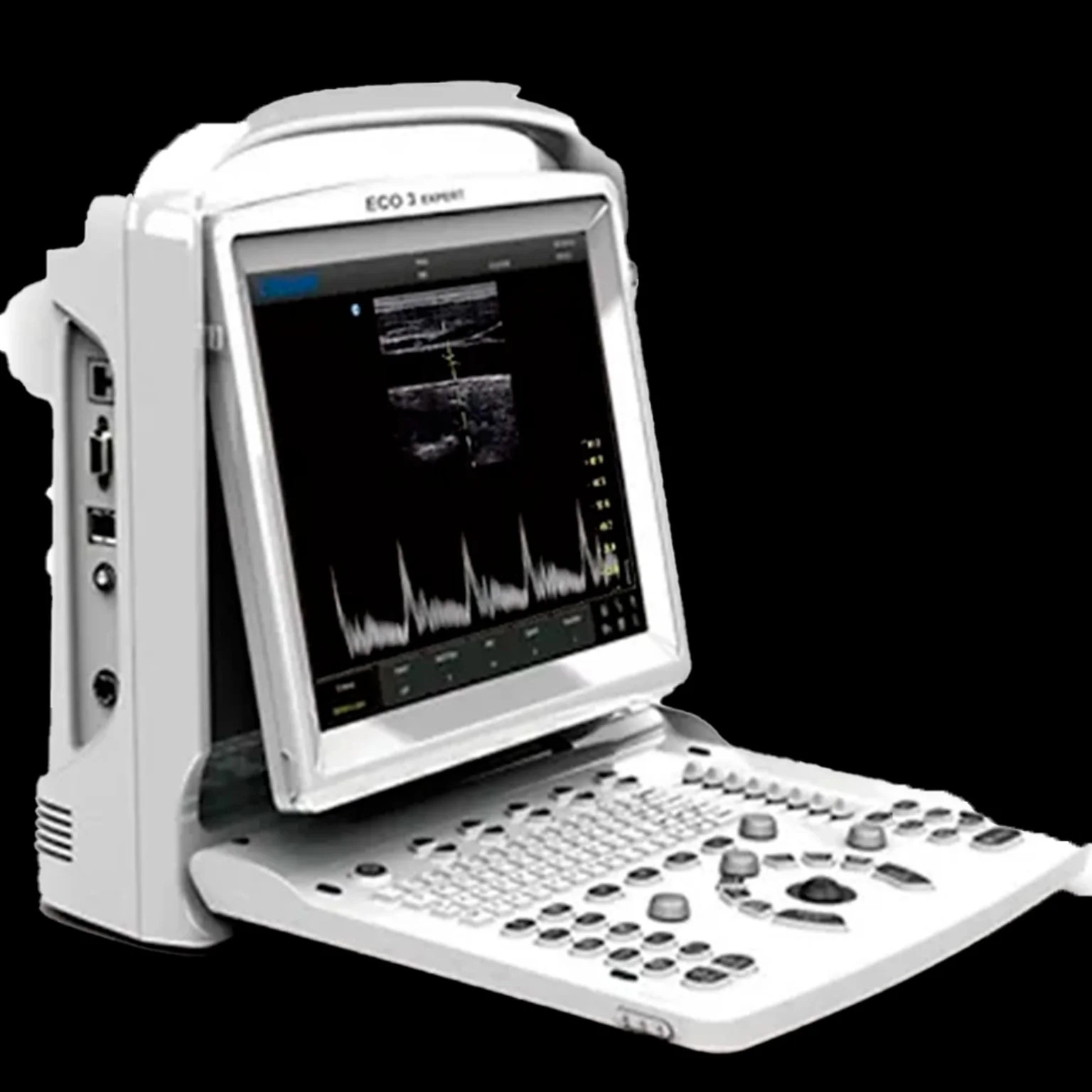 Ultrasonido Chison ECO3 PRO + Linealrectal