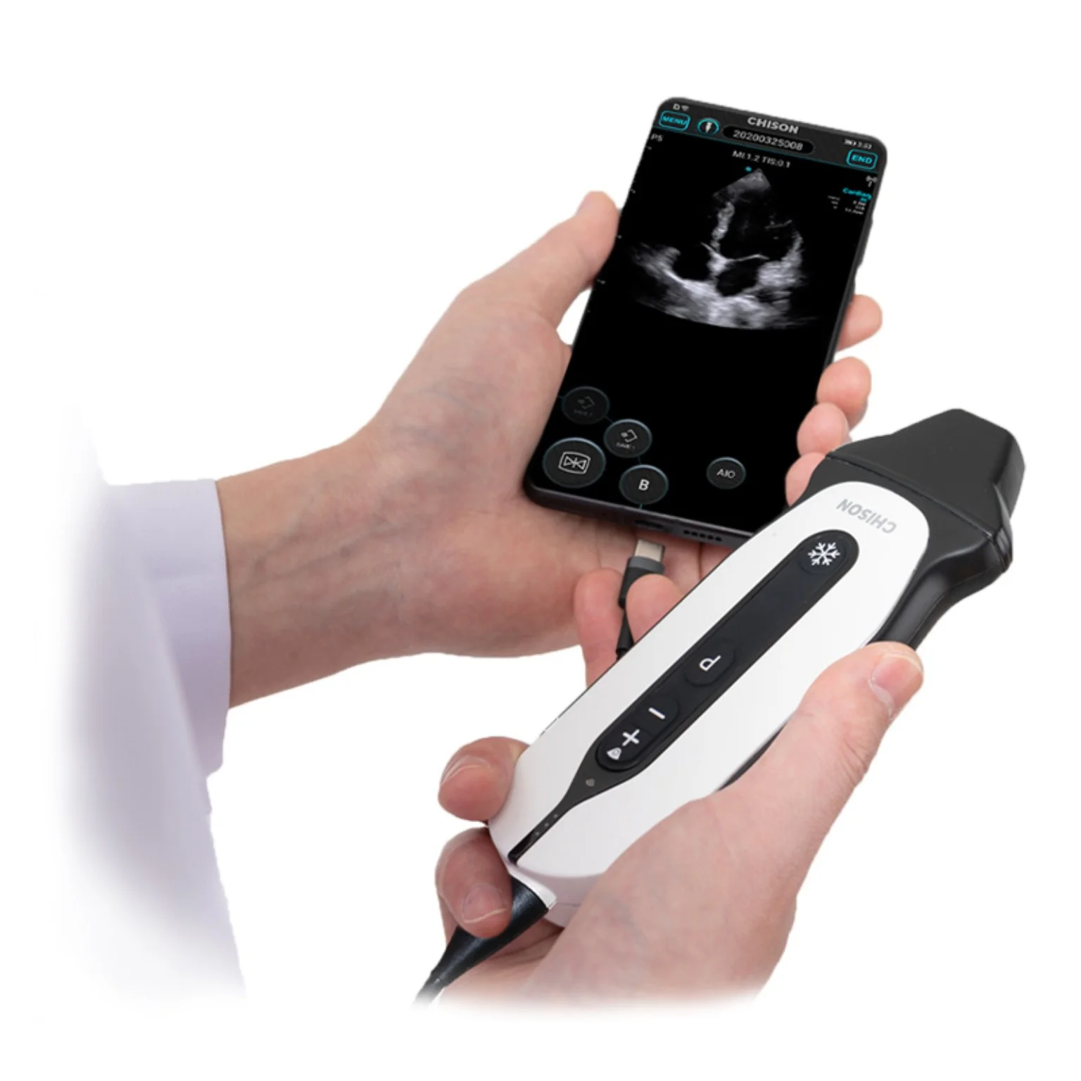 Ultrasonido Chison SONOEYE Modelo P5 / NO INCLUYE la tablet
